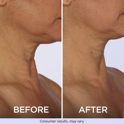 Tighten & Lift Neck Cream